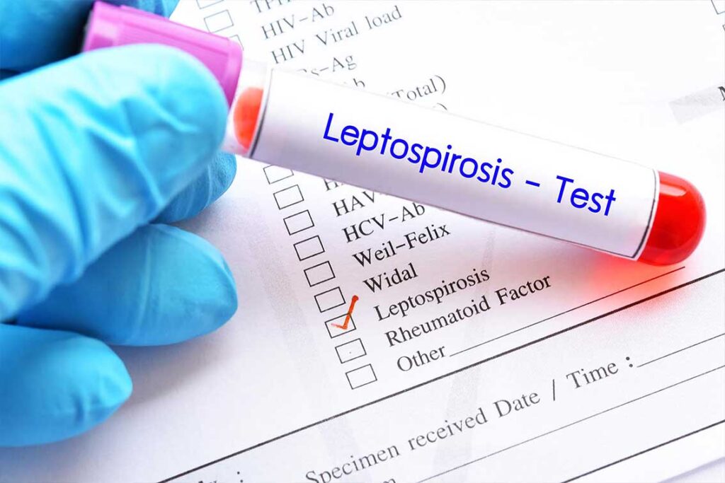 Penyakit Leptospirosis, Kuman yang Menyerang Hewan dan Bisa Menular pada Manusia 2023!
